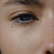 A tight crop of someone's facial skin, showing a blue-grey eye