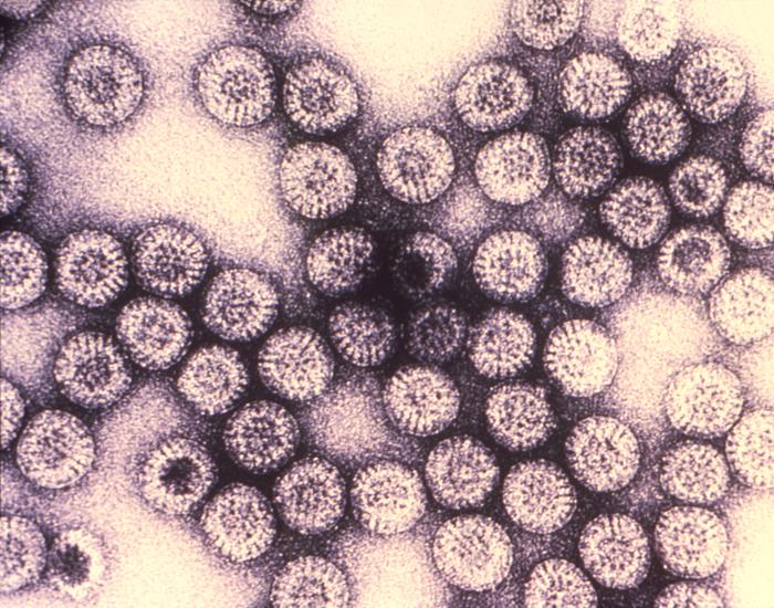 The 12 Deadliest Viruses On Earth | Live Science