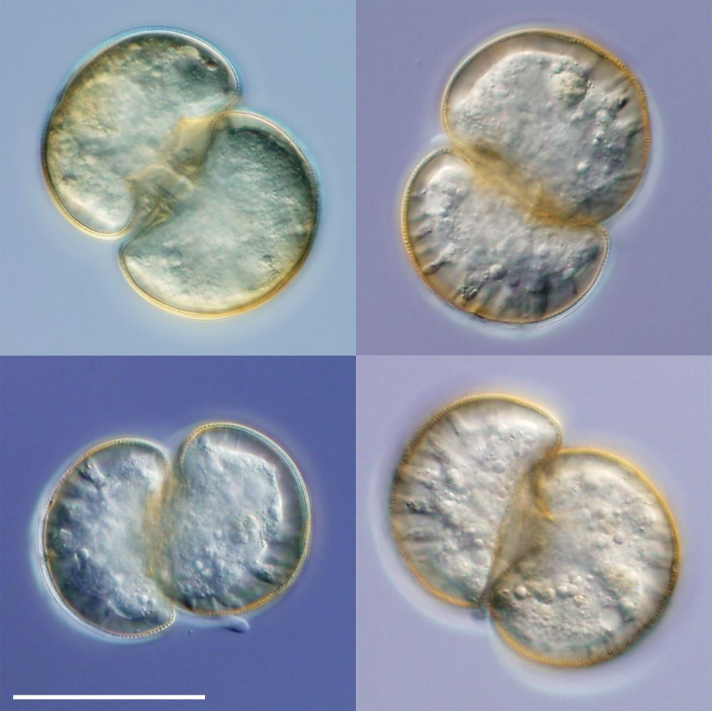 Ameoba, one of the most ancient organisms on the eukaryotic tree of life, are the originators of sex. 