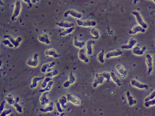 Naegleria-fowleri