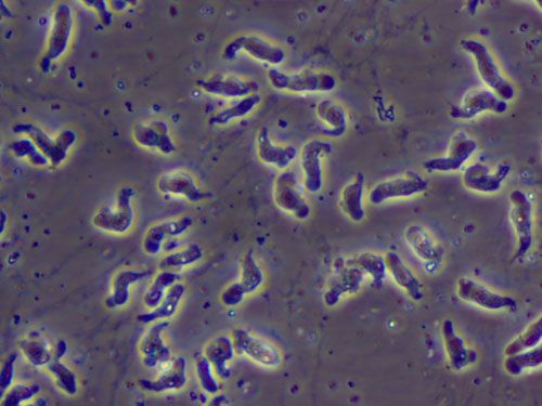 Naegleria-fowleri