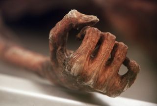 The mummified hand of Otzi the iceman, who died in the Alps some 5,300 years ago.