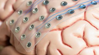 electrodes on fake brain