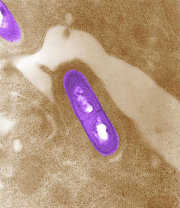 Listeria bacterium