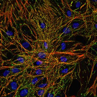 Immunofluorescence imaging of heart cells grown on the International Space Station.