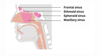 diagram shows a side profile of a human head with the four sinuses labeled