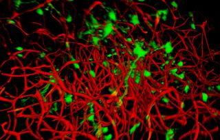 Images of the brain cells and blood vessels in one part of the mouse brain. The blood vessels are red and the brain cells are green.