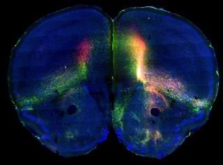Researchers injected mouse brains with tracers that would show both incoming and outgoing signals.
