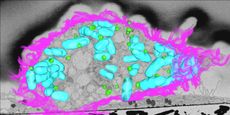 A 3D electon microscope image shows an infected macrophage (its cell surface is outlined in pink) with lipid droplets (green) near bacteria (blue). 