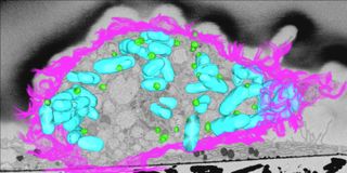 A 3D electon microscope image shows an infected macrophage (its cell surface is outlined in pink) with lipid droplets (green) near bacteria (blue). 