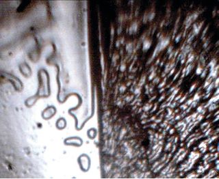 USB microscope image