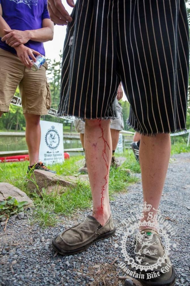 It wouldn't be a proper race without some blood being drawn