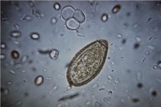 An image showing an egg of the parasitic worm Clonorchis sinensis, which is a type of liver fluke.