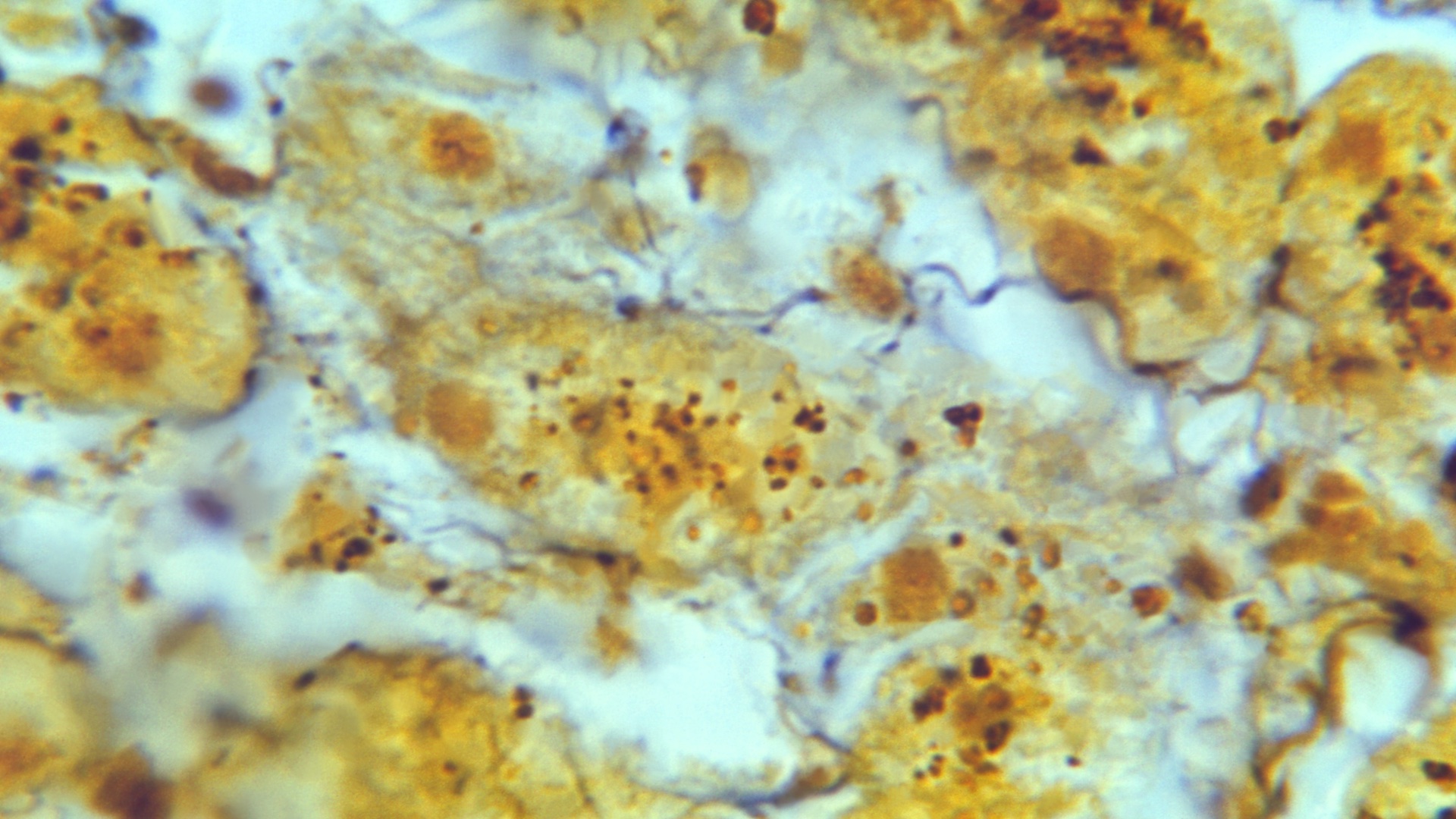 A liver tissue sample shows evidence of bacteria in the genus Leptospira