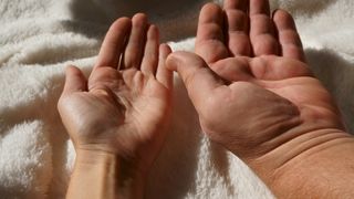 Two hands side-by-side on what looks like a white blanket. The hand on the left is noticeably smaller than the hand on the right. 