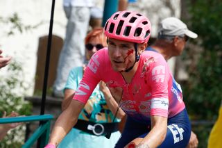 Battered and bruised from a crash, Tejay van Garderen finishes stage 7 at the Tour de France