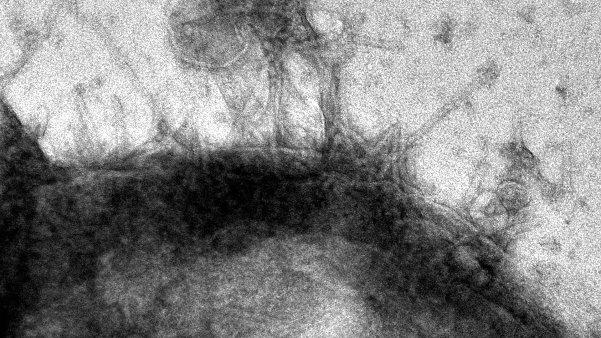 Image de microscopie en noir et blanc montrant des protéines en forme de tube se fixant à la surface d'une cellule cancéreuse