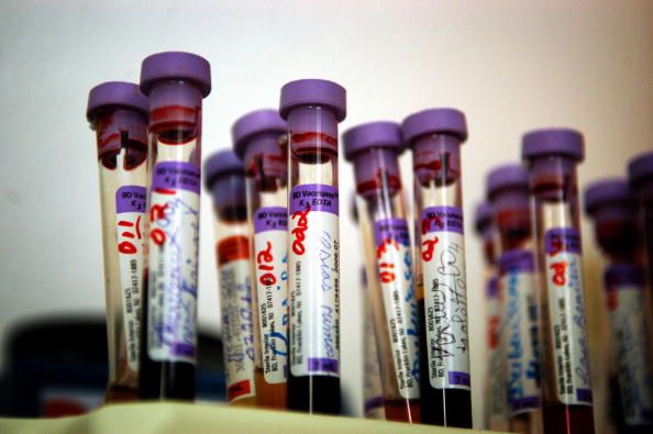 HIV test tubes