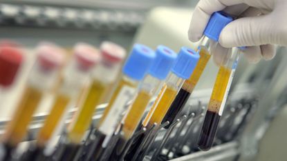 A new blood test could revolutionise preventative medicine 