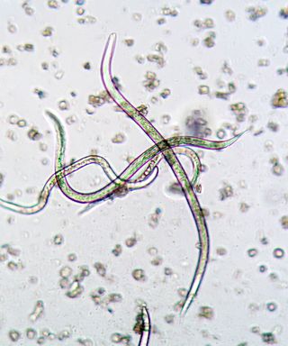 The beneficial nematode Steinernema feltiae under the microscope