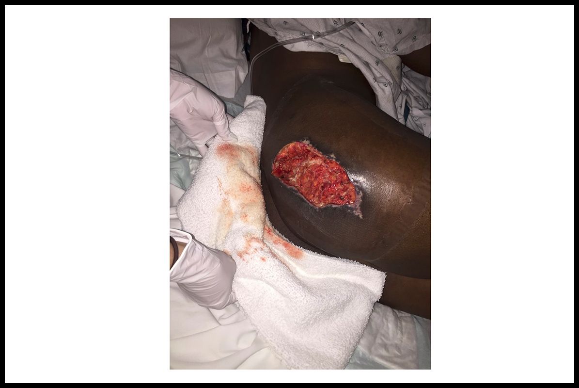 Photos from Goals patients