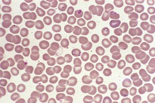 The dark pink specks in this microscopic image of blood are hemoprotozoan parasites called <em>Babesia</em>