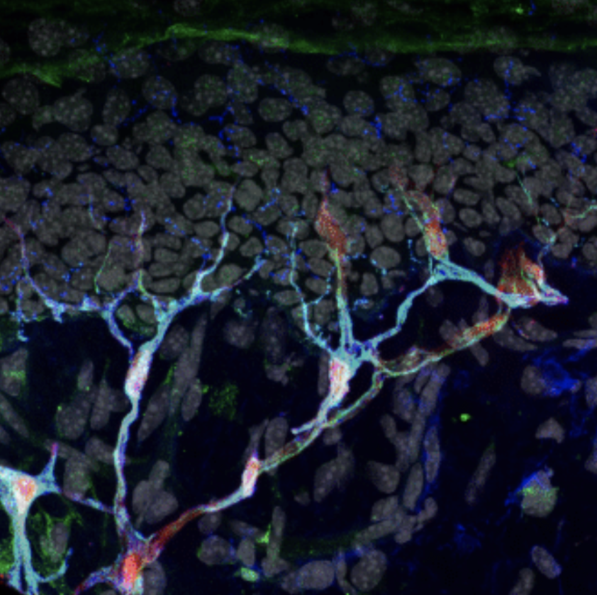 Researchers discovered a new organ sitting below the outer layer of the skin. The organ is made up of nerves (blue) and sensory glia cells (red and green).