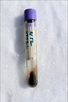 A scientists holds a vial of mammoth blood