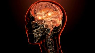 An artist&#039;s 3D rendering of a brain in the outline of a face and skull. There are two glowing dots near the center of the brain.