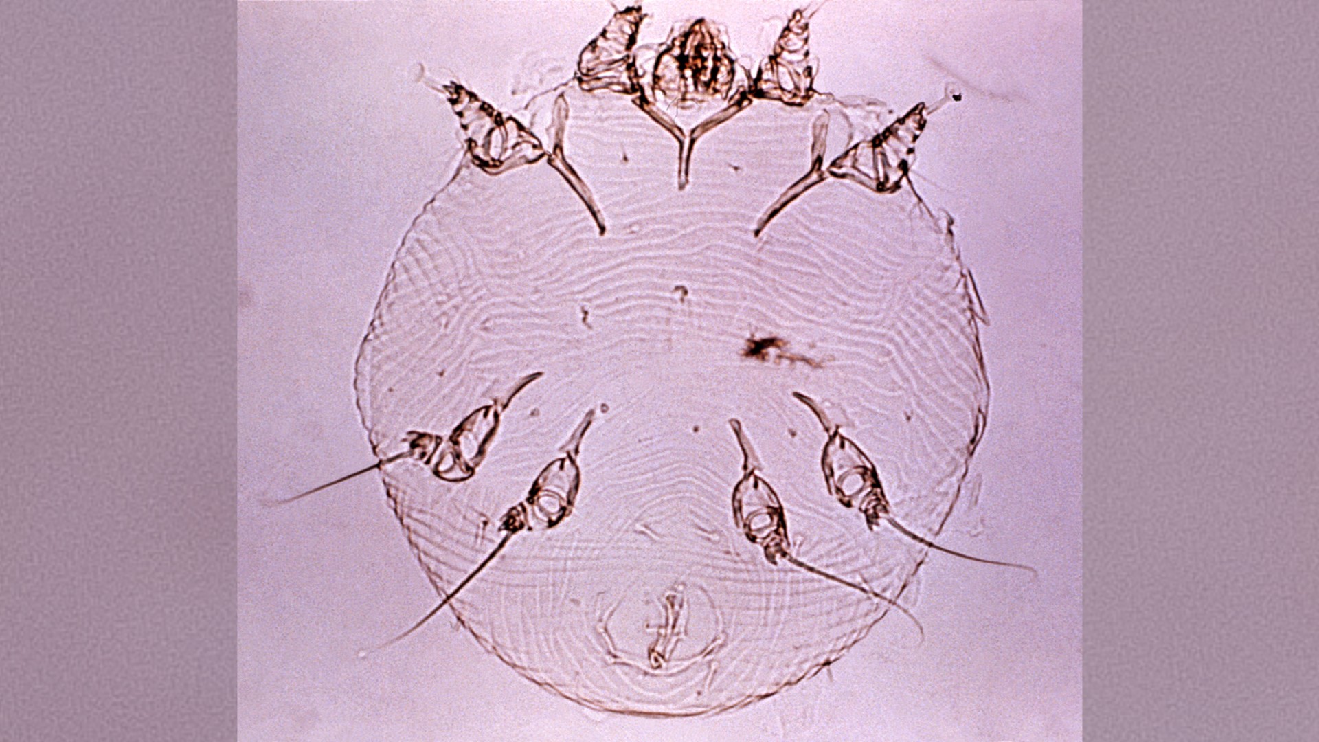 A photo of a scabies mite.
