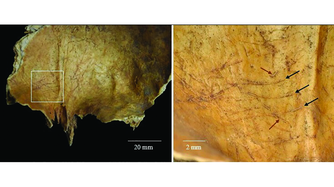 on the left, a photo of the inside of a human skull with scratch marks; on the right, a closeup showing the marks