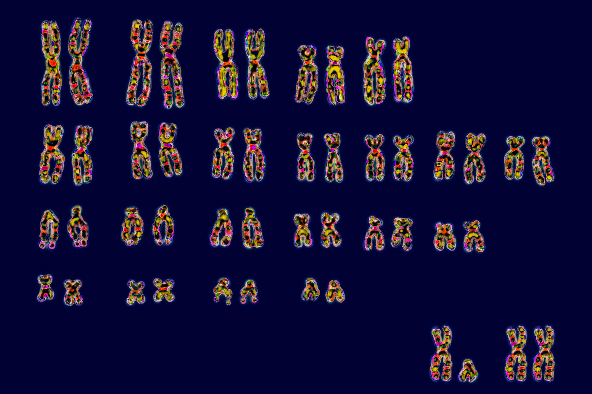 A series of chromosomes against a blue background as well as the x and y chromosomes