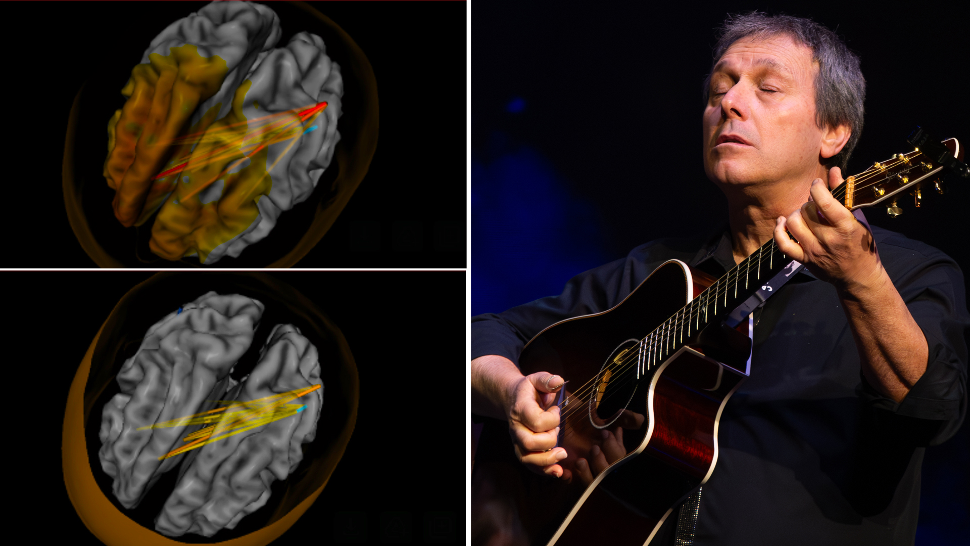 A composite photo showing guitarist Peppino D'Agostino playing acoustic guitar, alongside before-and-after scans displaying brain activity in a chronic pain sufferer before and during a listening session with D'Agostino's new music project, Calm the Storm