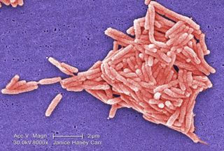 A scanning electron micrograph (SEM) image of Legionella bacteria.