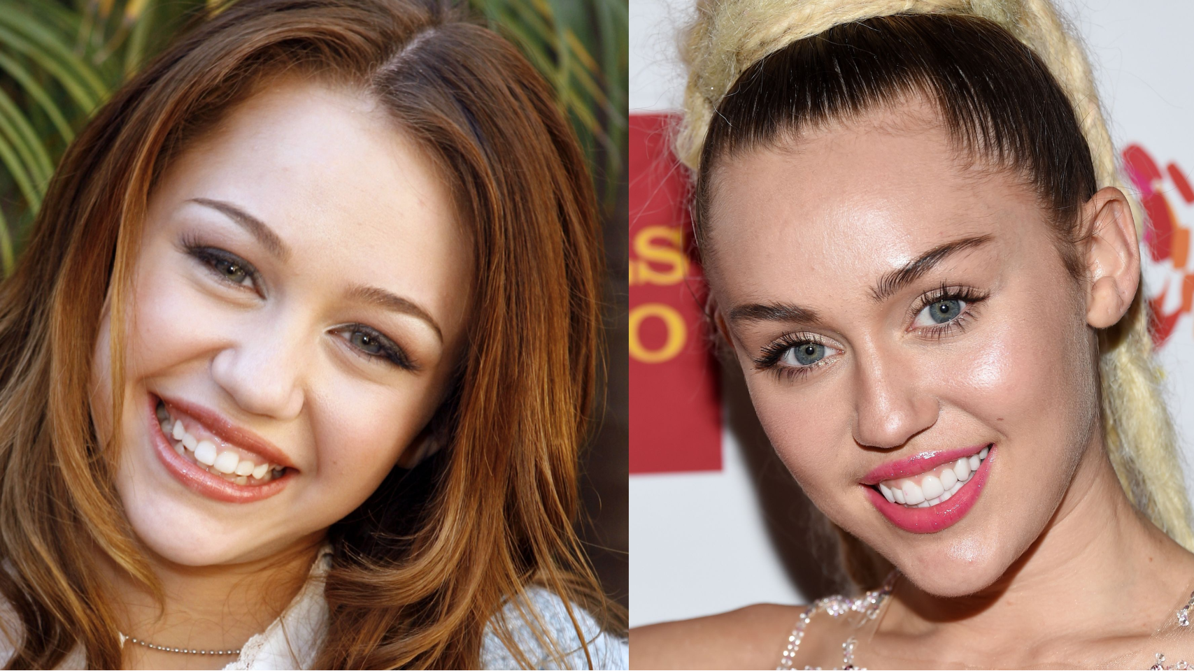 Celebs with overbite