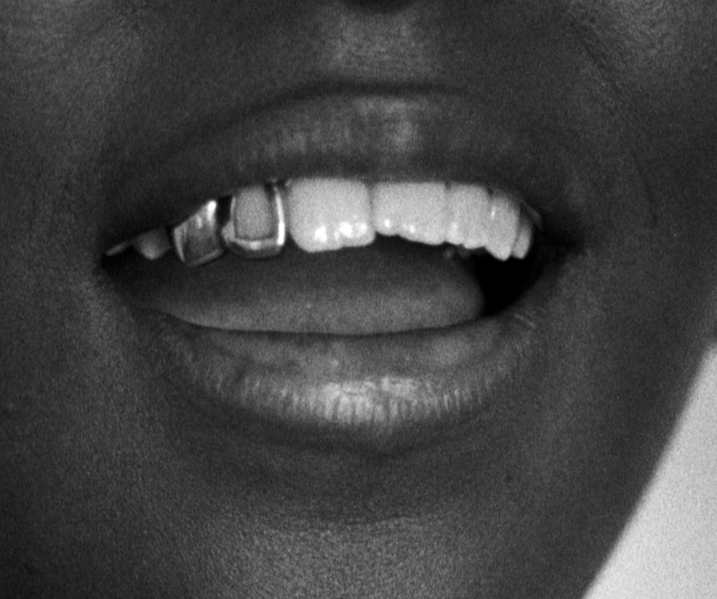 Black and white close-up photograph of a person’s mouth open and smiling. The person wears grills on their teeth