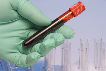 New blood test could improve cancer treatment
