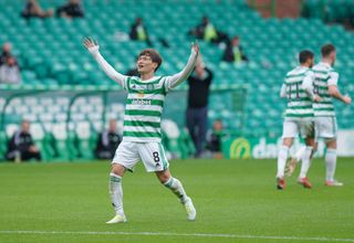 Celtic v Dundee – cinch Premiership – Celtic Park