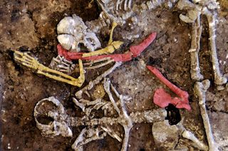 The bodies in the mass grave were not arranged, but rather jumbled together. Notice the broken limb bones, including the right humerus (yellow) and right femur (red).