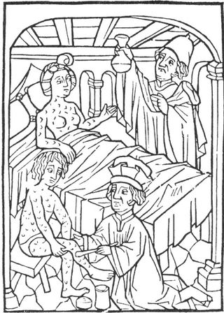 Earliest known medical illustration of syphilis, Vienna, 1498.