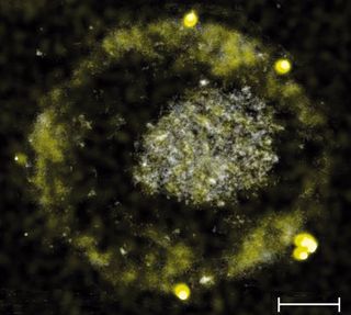 <i>C. metallidurans</i>, a soil bacteria that survives toxic metal exposure by excreting gold nuggets. 