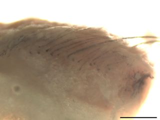 A microscopic view of the bioengineered skin substitute. The scale bar at the bottom of the image represents 0.5 millimeters.