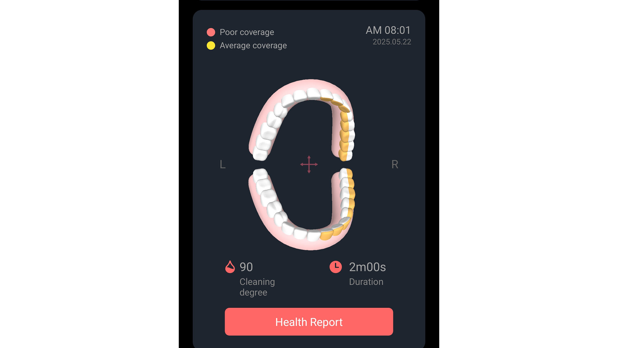 A screenshot of brushing coverage display from the Oclean Care+ app