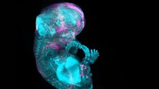 a blue and purple image of a developing fetus, showing its cartilage and bones