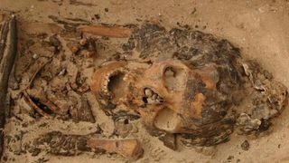 This woman, who was between age 20-29 at time of death, was found buried with a head cone made of beeswax. She lived more than 3,300 years ago and was buried in a cemetery at the site of Amarna in Egypt.