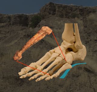 Fourth-metatarsal bone Bones of a human foot showing the arched configuration and the location of the fourth metatarsal (the type of bone thought to belong to an early human ancestor some 3.2 million years ago).