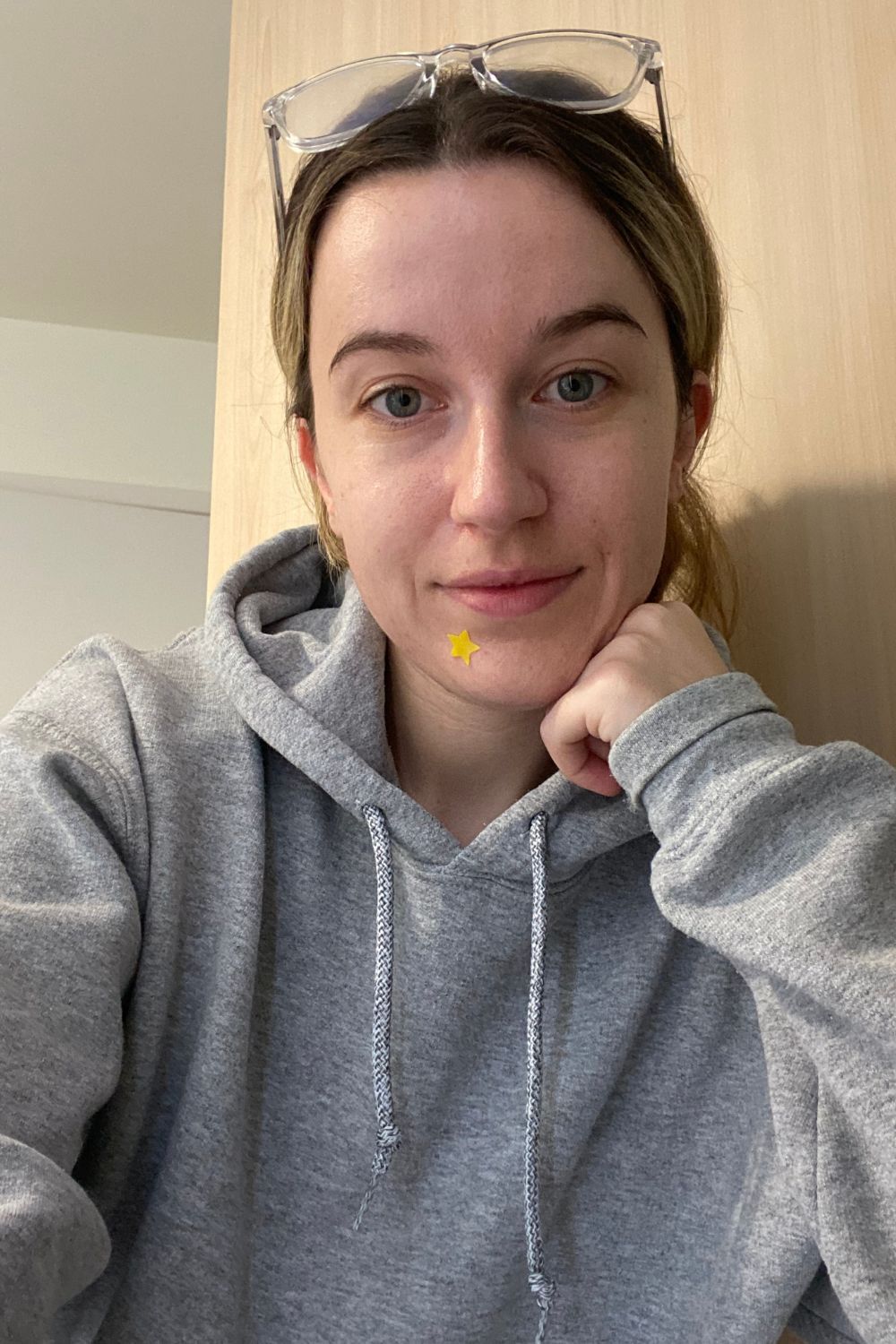 Grace Lindsay wearing Starface acne patches