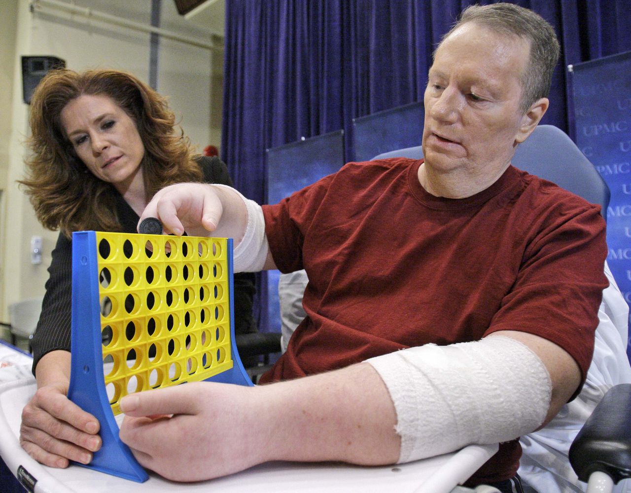 Jeff Kepner has lost all hand function since his hand transplant.