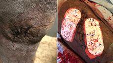 wound-for-web-1.jpg