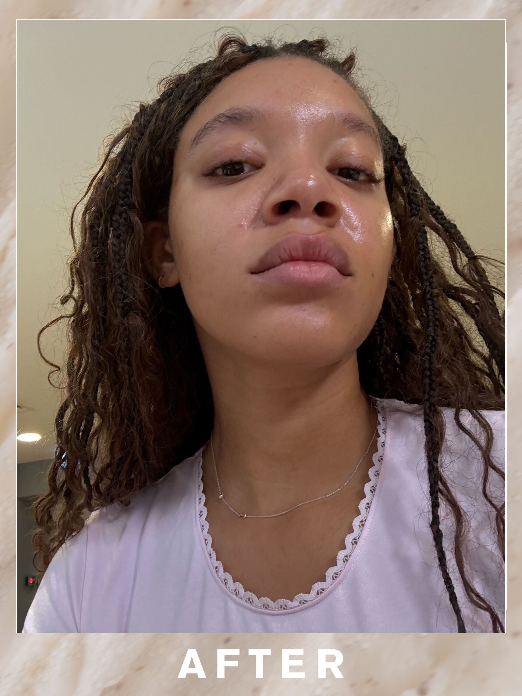 17 Best Facials in London, Tried and Tested by Editors